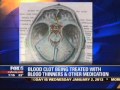 Dr. Ed Kornel on Fox 5 discussing Hillary Clinton blood clot