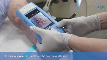 Using MANUAL MODE for Digital Wound Area Measurement with the MolecuLight i:X® device