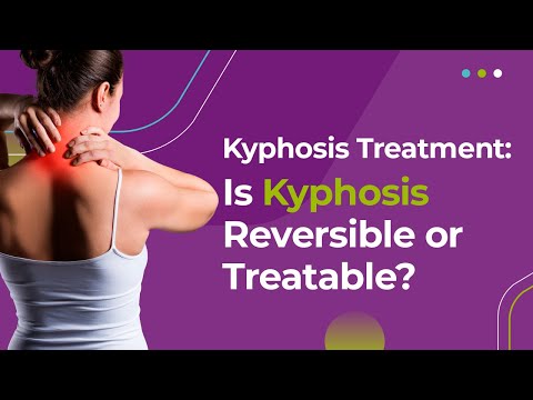 Kyphosis Treatment: Is