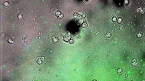 [JuLI Stage Application Video] Cell cytotoxicity with capturing image of GFP bacteria & macrophage