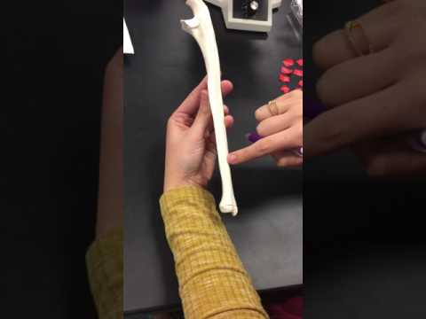IMG 22721
