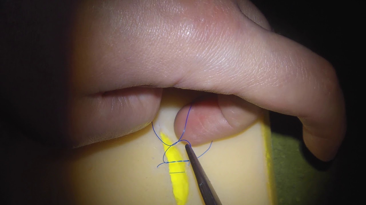 Tension relieving surgical knot
