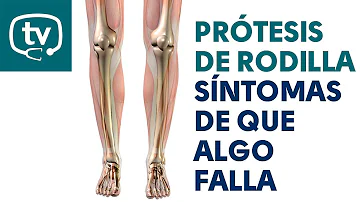 ¿Cuál es la flexión máxima tras una prótesis de rodilla?