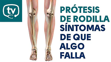 ¿Cuáles son los síntomas de una prótesis de rodilla?
