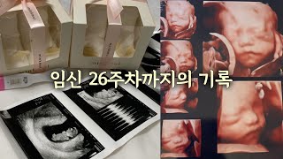 26주차 임산부의 기록 | 이란성쌍둥이 | 남매둥이 | 임밍아웃 | 입체초음파로 보니 좀 더 사람(?) 같고 귀엽다🩷👶🏻👶🏻