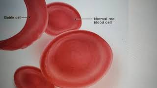 Pathology of Blood and Urine Part 1