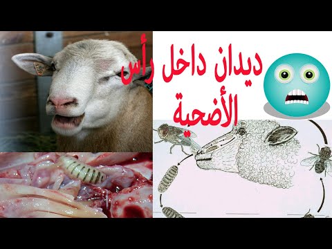 فيديو: علاج ومنع نزلات البرد اثناء الحمل