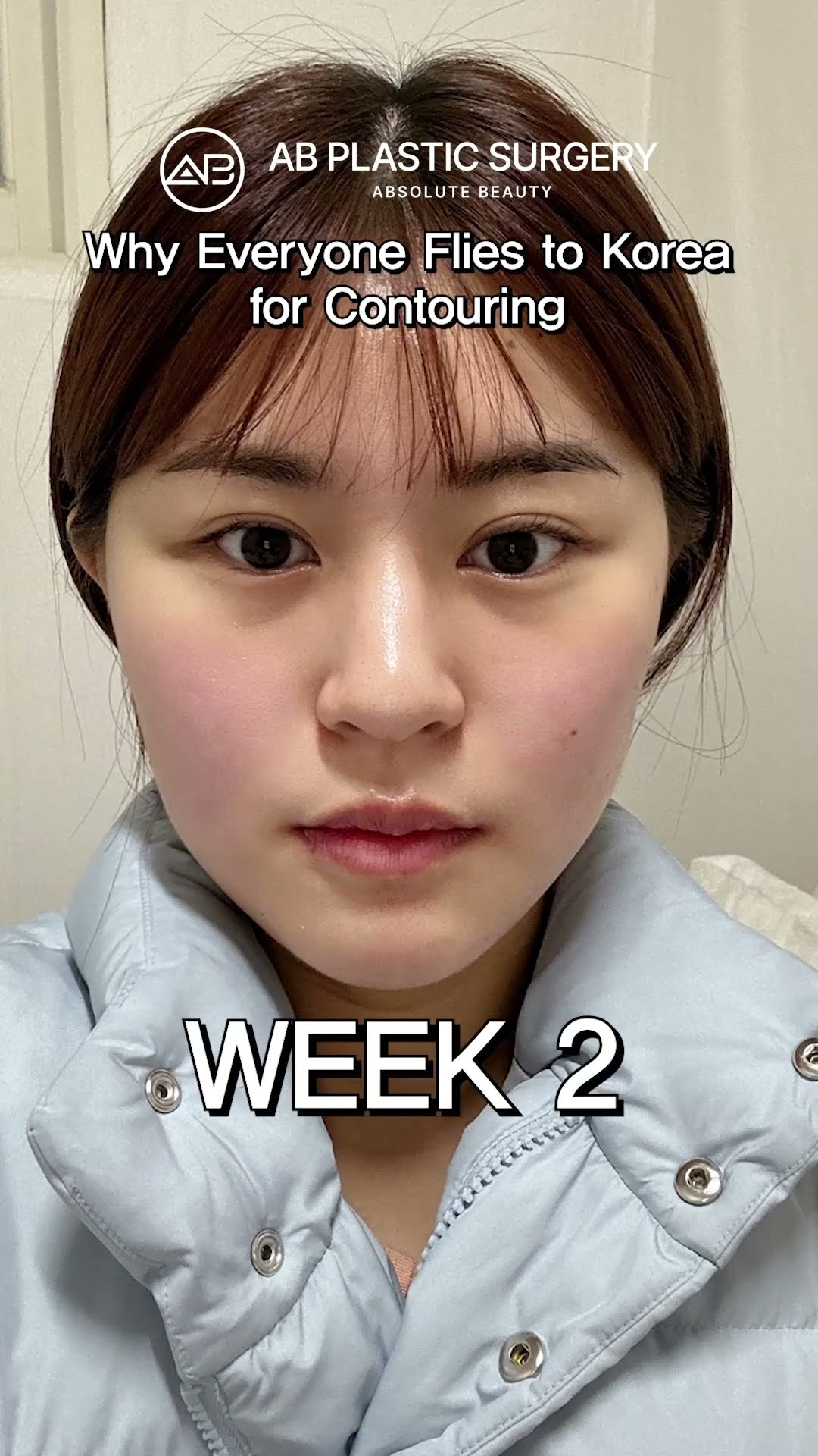 Why Everyone Flies to Korea for Contouring #shorts