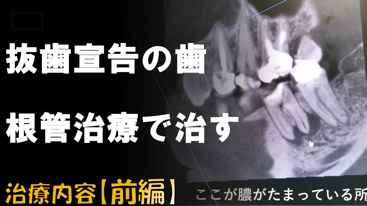 あなたの根管治療はここがまちがっている! あなたの根管治療はここがまちがっている! | 鶴町 保 |本 | 通販