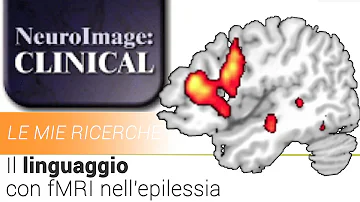 Cosa controlla il lobo temporale destro?