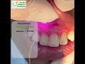 GENERAL DENTISTRY WITH IMPLANT COURSE -3 MONTHS, CLINICAL EXPOSURE: 75–100 PATIENTS