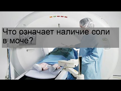 Что означает наличие соли в моче?