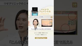 毛穴の奥の汚れを洗い出す #ハイドラフェイシャル