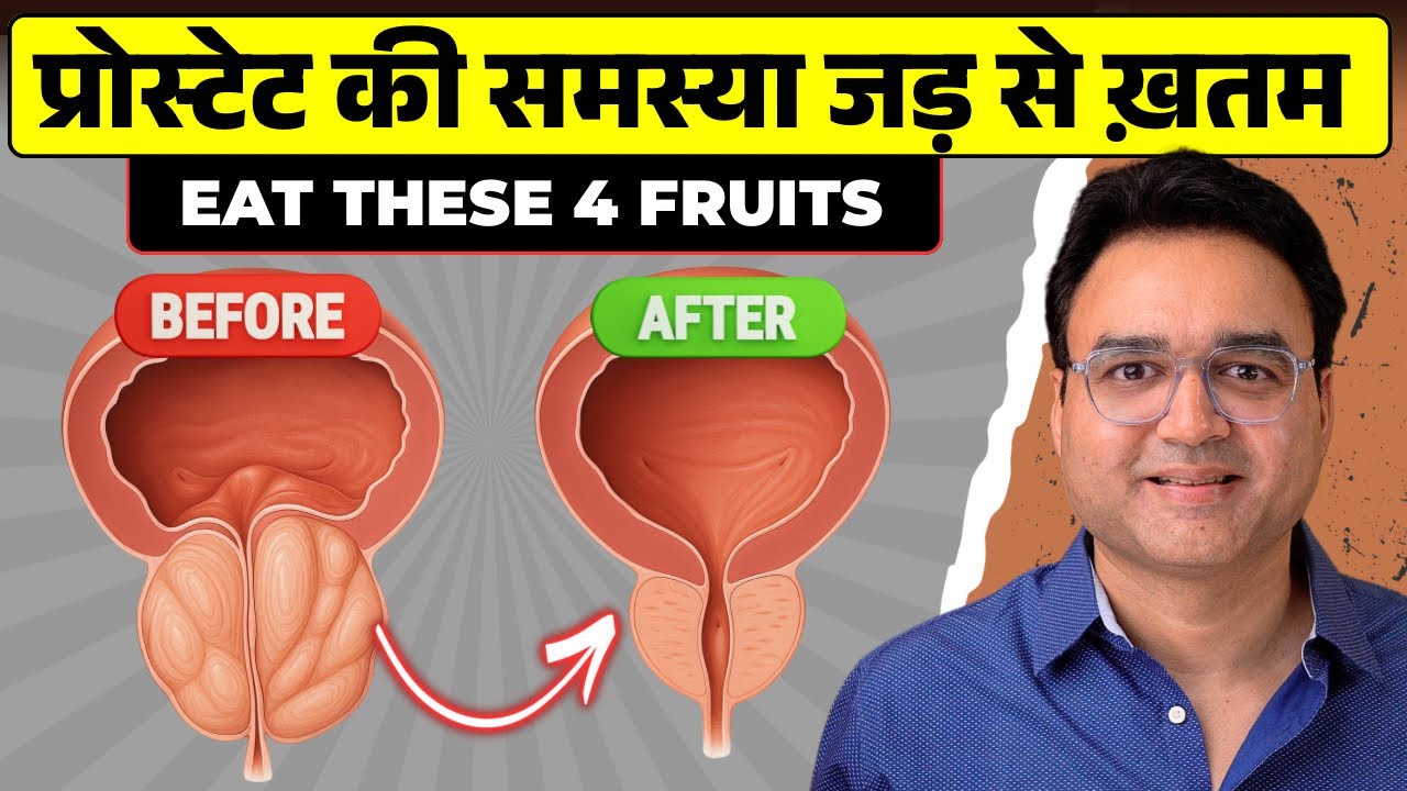 Prostate Enlargement: बढे हुए प्रोस्टेट को सिकोड़ने में मदद करेंगे ये 4 शक्तिशाली फल