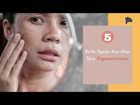 Facts About Skin Pigmentation | Melasma | Hyperpigmentation | Skin Care Facts @clickoncaredotcom