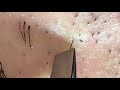 【pull out the beard】ずっと見てられる月末のヒゲ抜き 2018.4.30