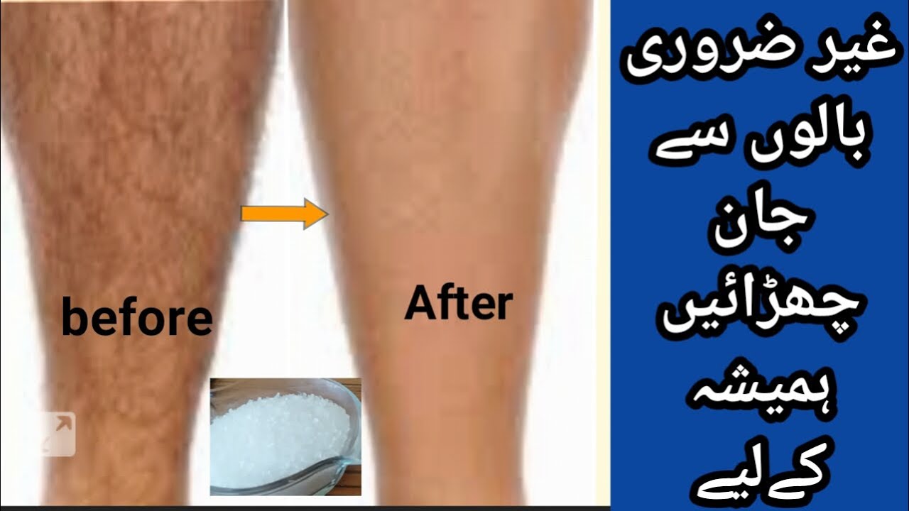 How To Do Wax At Home For Beginners Urdu/Hindi Get Rid Of Unwanted
