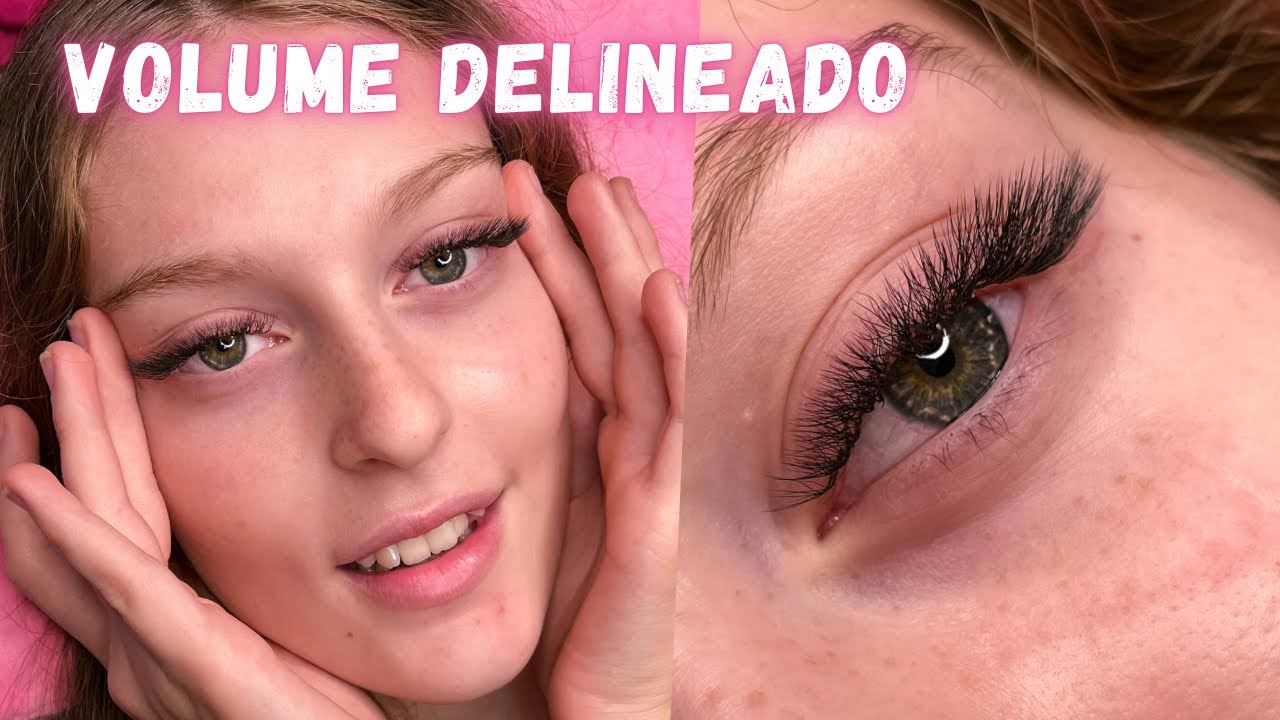 APLICAÇÃO VOLUME DELINEADO NA PRÁTICA