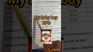 my baby boy BPD in ultrasound #ultrasound