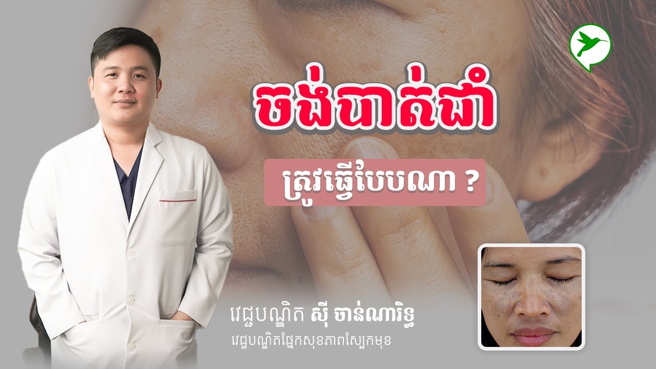 មុខឡើងជាំ ជាំដោយសារមានកូន តើអាចបាត់ទៅវិញដែរឬ ទេ? Beauty Click