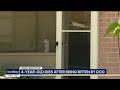 Dallas 4-year-old dies after being bitten by dog