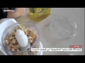 إصابة 30 طفلا أميركيا ببكتريا السالمونيلا 