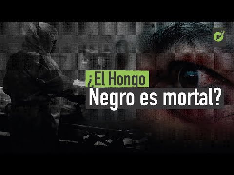 Vídeo: Ojo Negro: Causas Y Tratamiento