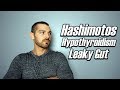 Hashimotos & Hypothyroidism | Road To Recovery