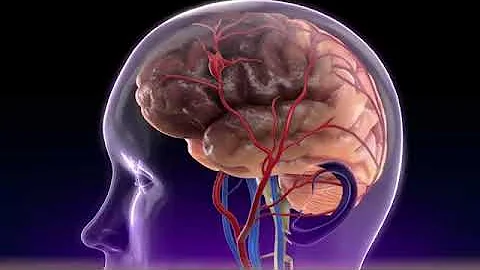 understanding the different types of stroke 3D animation 🙂🙂🙂🙂🙂❤️❤️❤️❤️😮😮😮