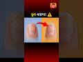 নখে সাদা দাগ = Calcium Problem? 😱 | Truth Revealed. #shortsfeed #shorts #amazing