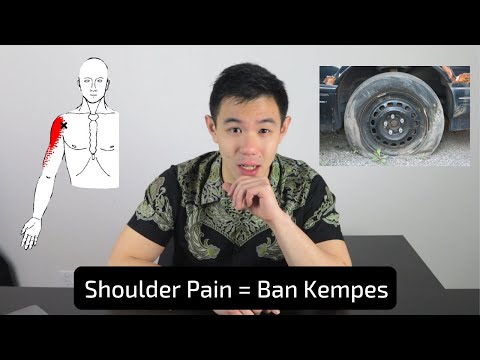 Cara Menyembuhkan Cedera Shoulder / Bahu