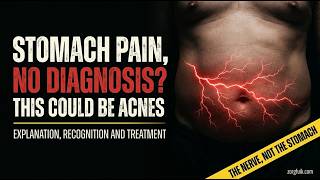 Thumbnail of ACNES: The Often-Missed Cause of Chronic Abdominal Pain