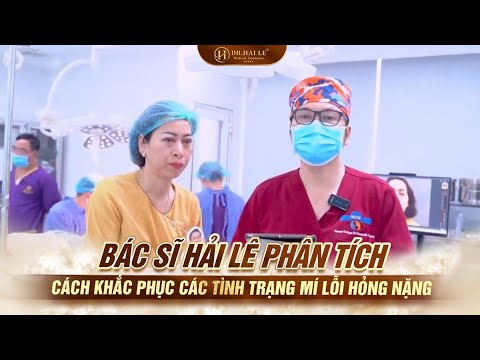 Bác sĩ Hải Lê phân tích cách khắc phục các tình trạng mí lỗi hỏng nặng