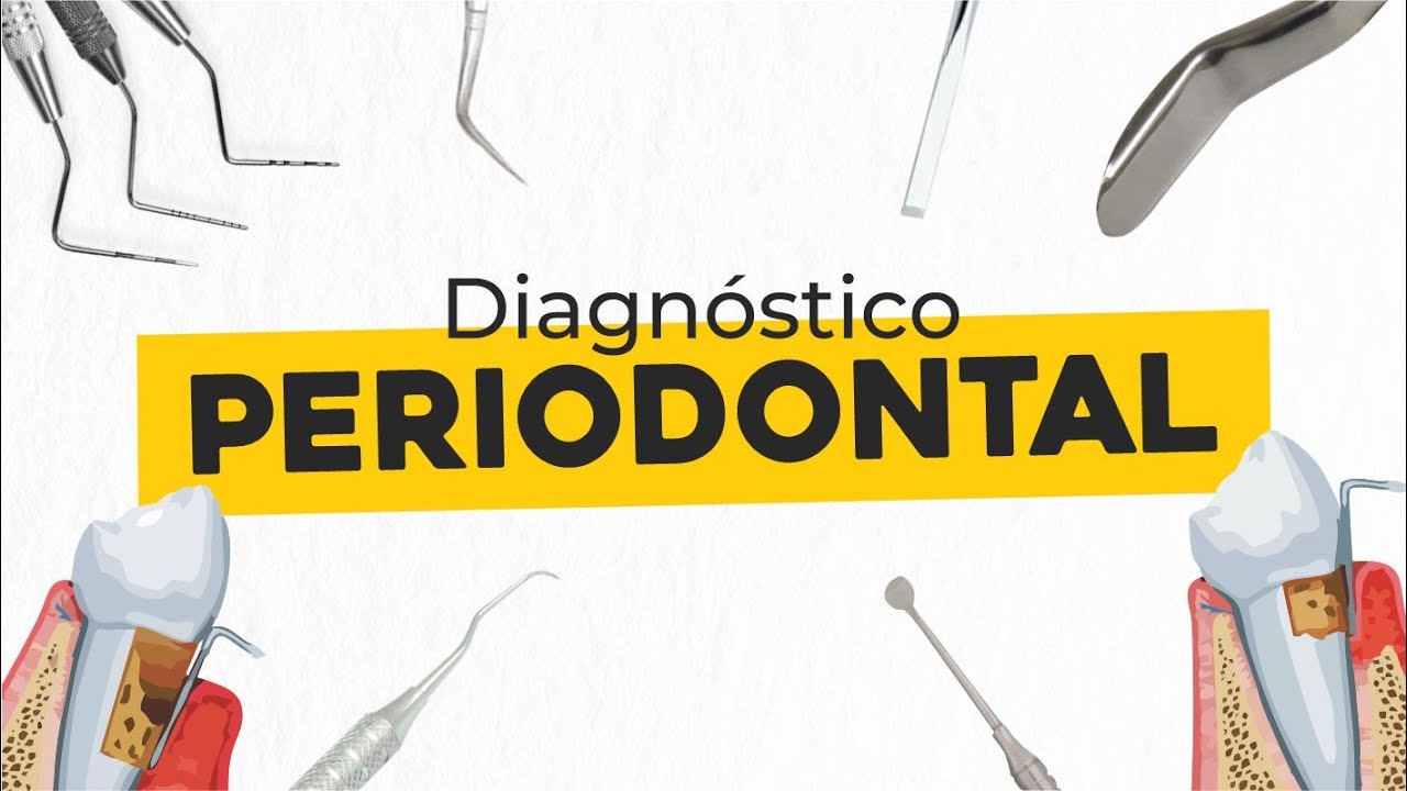 Nova classificação da periodontite | PERIODONTIA