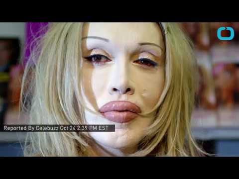 Videó: Pete Burns Net Worth