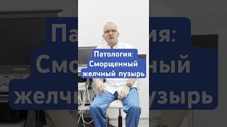 Патология: Сморщенный желчный пузырь  #узи #ultrasound #доктор #желчныйпузырь