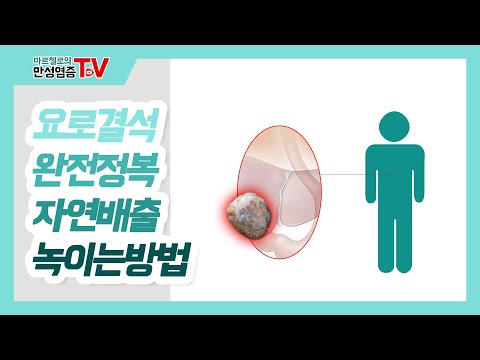 요로결석 완전정복 자연배출 녹이는방법