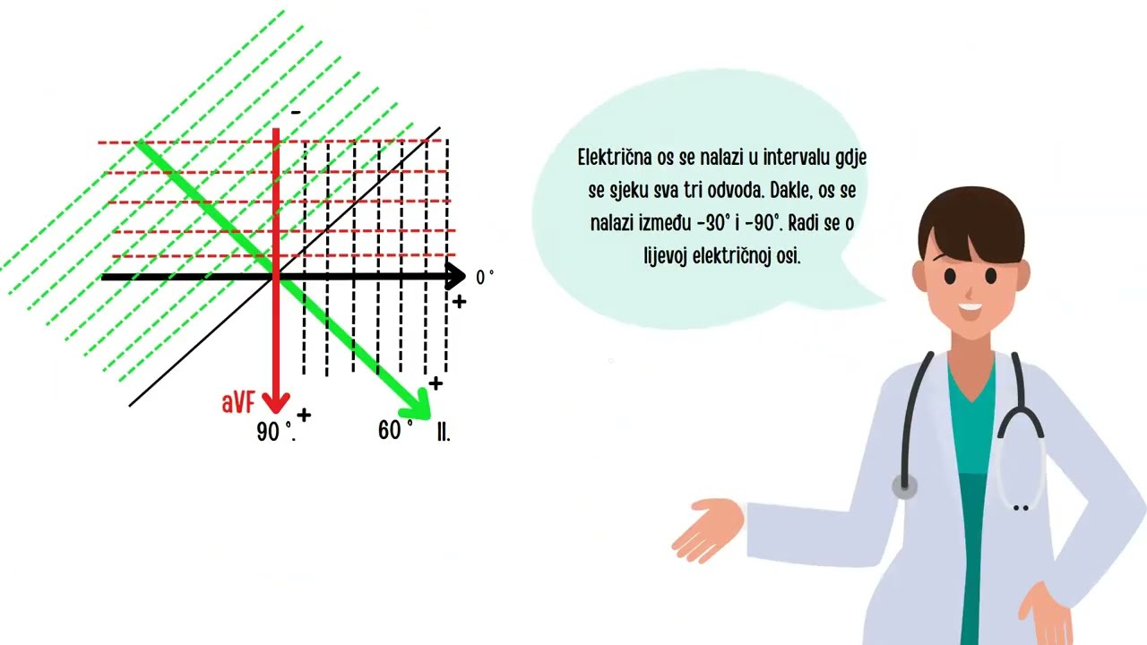 8.EKG: FROHI- određivanje srčane osi