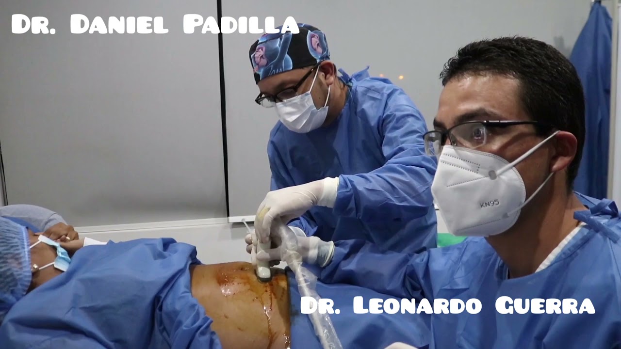 Amniocentesis