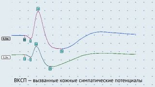 ВКСП — вызванные кожные симпатические потенциалы