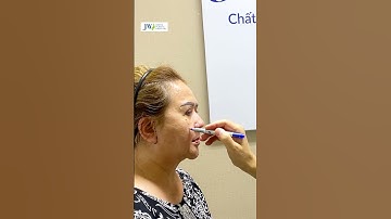 Bác sĩ Tú Dung CĂNG DA MẶT SMAS giúp Quý bà mặt hết chảy xệ trẻ đẹp phơi phới