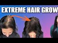 30 Days Extreme Hair ReGrowth Challange बालों की *Density और Volume बढ़ाने की Remedy 💖