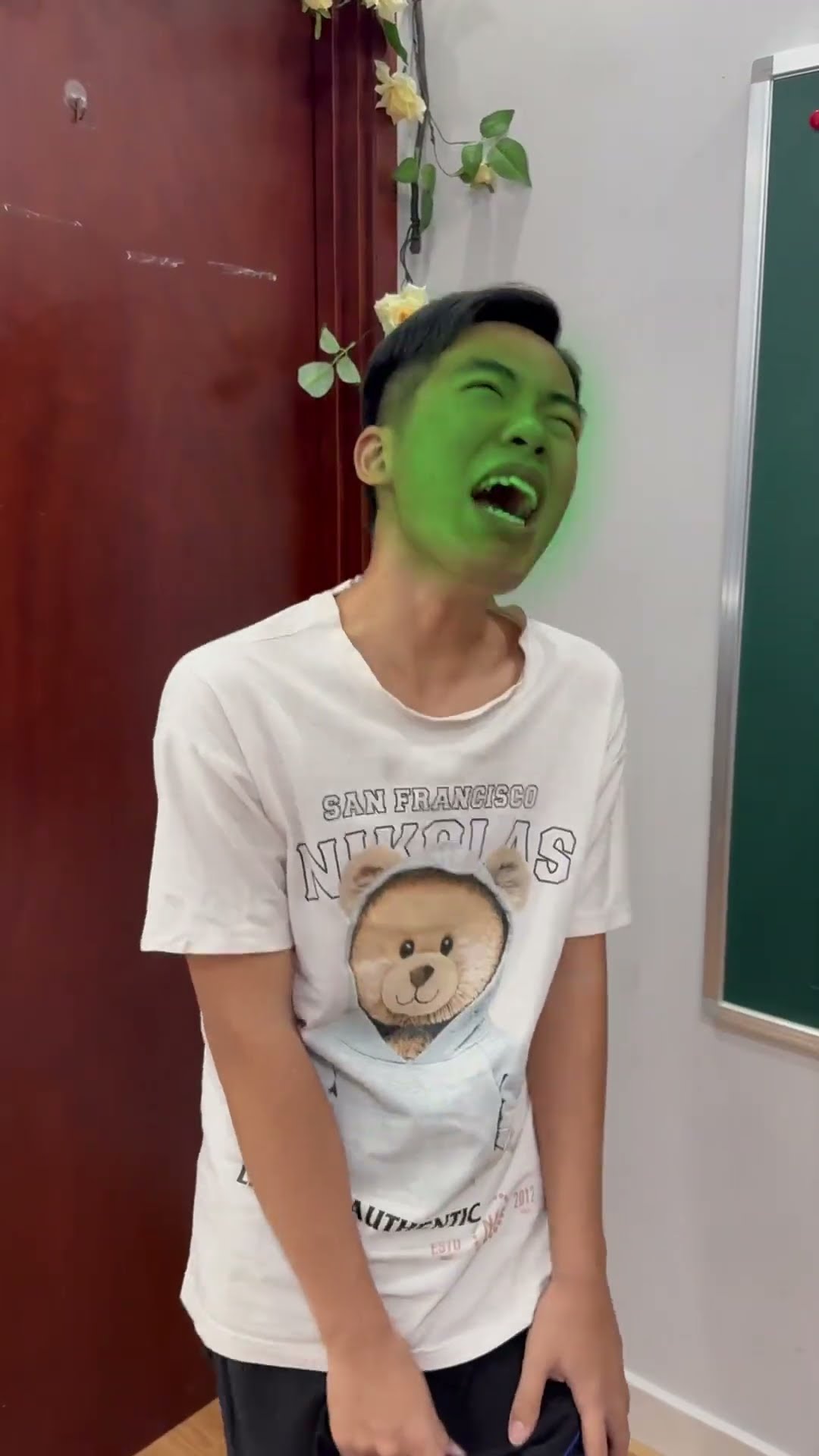 LNF - Phản ứng của tôi khi chân bị đau || My reaction when my foot hurts #shorts