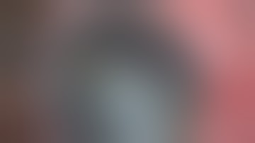 Stop and Chop technique in Phacoemulsification