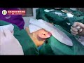 10.精灵耳+耳后基底提升 | 10. Elf Ears + Ear Base Lifting