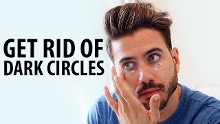 How To Get Rid of Dark Circles | Remove Wrinkles and Bags from Under Your Eyes | Alex Costa