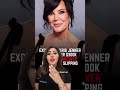 The internet is going crazy over Kris Jenner’s $300k facelift “dropping”… but let’s be clear.