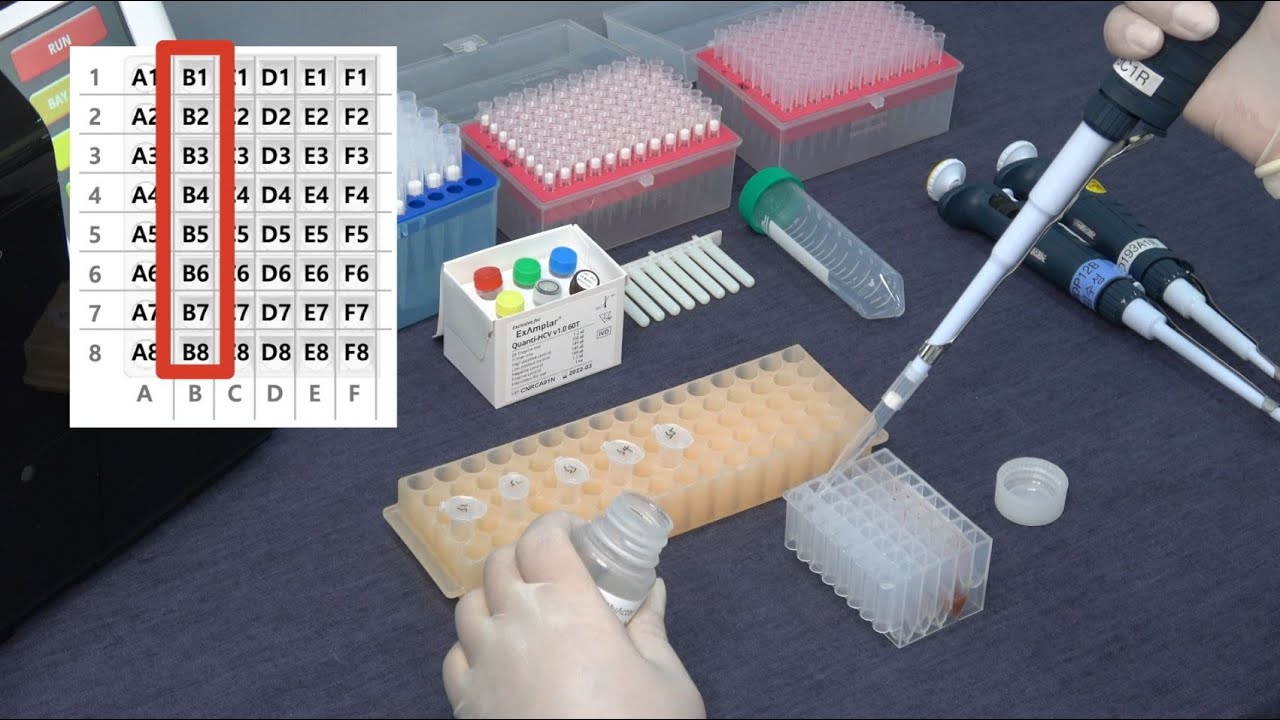NuActor and ExAmplar HCV/HIV-1 - Test Procedure