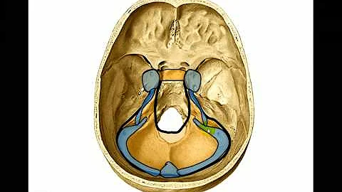 Dove si trova il seno venoso cerebrale?