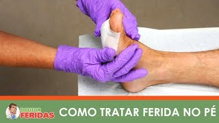 Do pé tratamento dedo de úlcera do